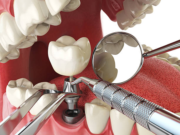 Best Emergency Dental Extractions in Tybee Island, GA